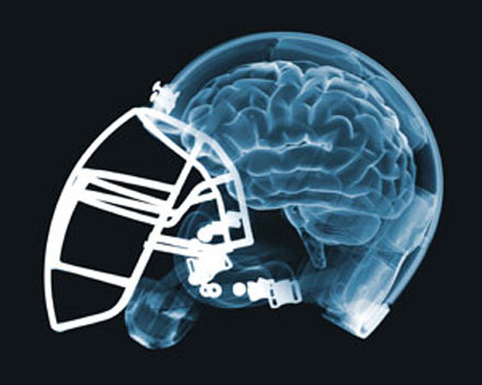 National youth sports safety advocate Kimberly Archie: “The more hits you have, the more likely you are to suffer brain damage.” Purdue University concussion researcher Larry Leverenz said changes in brain function in football players are “directly related” to the number of blows to the head.