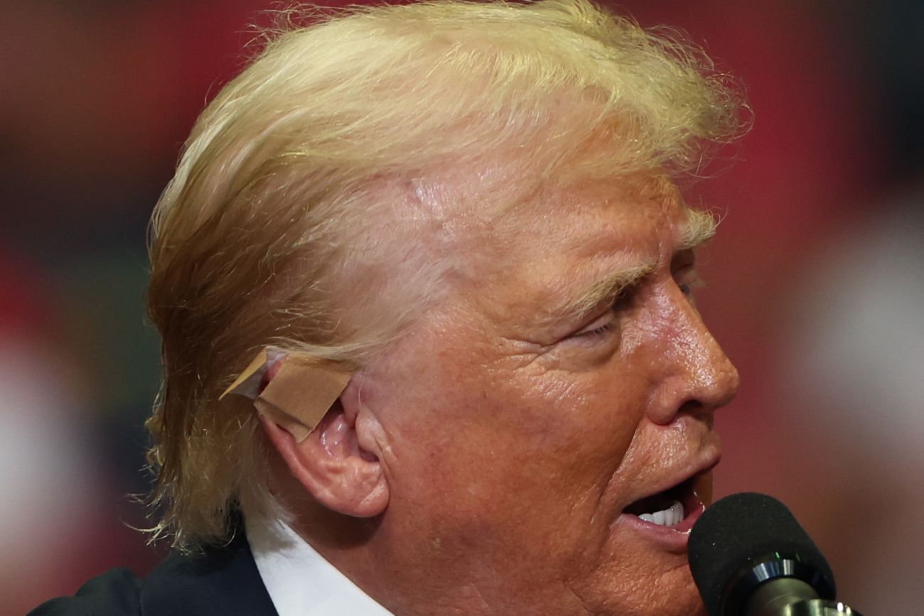 A Band-Aide begins to fall off Donald Trump's ear